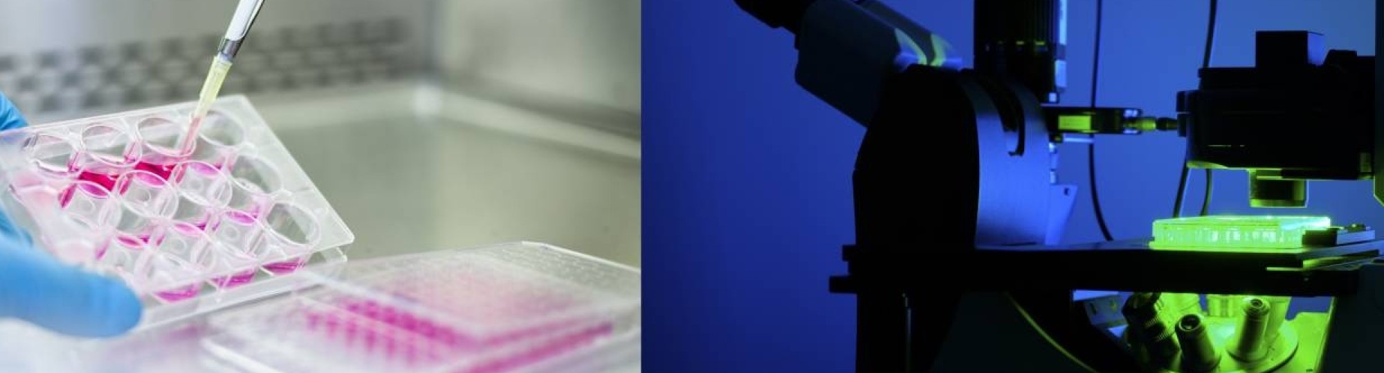 Organoid, microscoop en labonderzoek staan voor drug discovery.